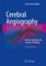 Cerebral Angiography