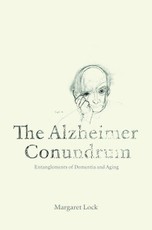 Alzheimer Conundrum
