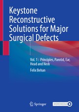 Keystone Reconstructive Solutions for Major Surgical Defects