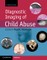 Diagnostic Imaging of Child Abuse