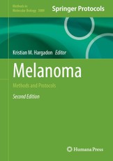 Melanoma