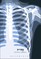 Lobdell, N: X-ray
