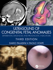 Ultrasound of Congenital Fetal Anomalies