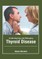 Understanding and Managing Thyroid Disease