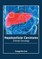 Hepatocellular Carcinoma: Clinical Oncology