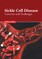 Sickle Cell Disease: Concerns and Challenges