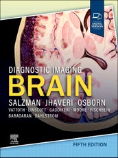 Diagnostic Imaging: Brain,