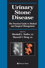 Urinary Stone Disease