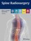 Spine Radiosurgery