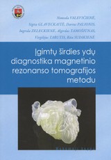 Įgimtų širdies ydų diagnostika magnetinio rezonanso tomografijos metodu