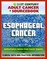 21st Century Adult Cancer Sourcebook: Esophageal Cancer (Cancer of the Esophagus) - Clinical Data for Patients, Families, and Physicians