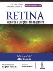 Retina