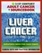 21st Century Adult Cancer Sourcebook: Liver Cancer, Hepatocellular Carcinoma (HCC) - Clinical Data for Patients, Families, and Physicians