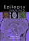 Epilepsy Simplified
