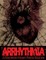 Arrhythmia