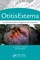 Otitis Externa