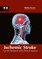 Ischemic Stroke: Current Research and Clinical Aspects