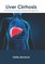 Liver Cirrhosis: From Pathophysiology to Disease Management