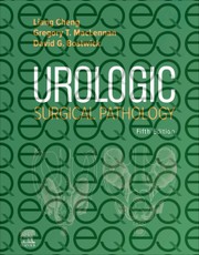 Urologic Surgical Pathology