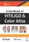 A Handbook of Vitiligo and Color Atlas