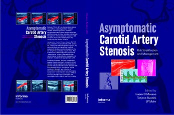 Asymptomatic Carotid Artery Stenosis