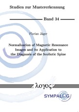 Normalization of Magnetic Resonance Images and Its Application to the Diagnosis of the Scoliotic Spine