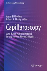 Capillaroscopy