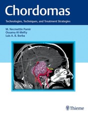 Chordomas
