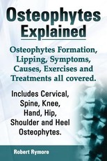 Osteophytes Explained. Osteophytes Formation, Lipping, Symptoms, Causes, Exercises and Treatments All Covered. Includes Cervical, Spine, Knee, Hand, H