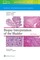 Epstein, J: Biopsy Interpretation of the Bladder