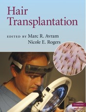Hair Transplantation