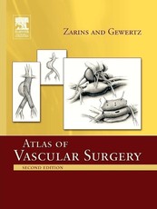 Atlas of Vascular Surgery - Paperback Edition