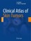 Clinical Atlas of Skin Tumors