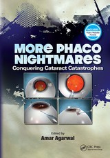 More Phaco Nightmares