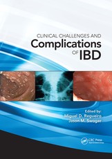 Clinical Challenges and Complications of Ibd