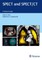 SPECT and SPECT/CT