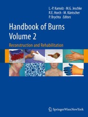 Handbook of Burns. Volume 2
