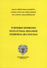 Turnerio sindromo nustatymas, dinaminė stebėsena ir gydymas