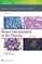 Biopsy Interpretation of the Thyroid