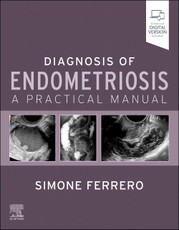 Diagnosis of Endometriosis