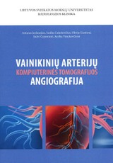 Vainikinių arterijų kompiuterinės tomografijos angiografija