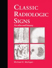 Classic Radiologic Signs