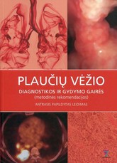 Plaučių vėžio diagnostikos ir gydymo gairės