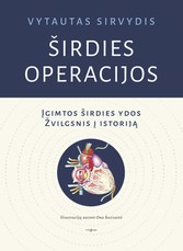 ŠIRDIES OPERACIJOS. Įgimtos širdies ydos. Žvilgsnis į istoriją
