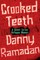 Crooked Teeth