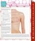 Breast Self-Examination