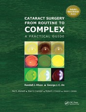 Cataract Surgery from Routine to Complex