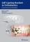 Self-ligating Brackets in Orthodontics