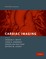Cardiac Imaging