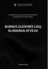 Burnos gleivinės ligų klinikiniai atvejai